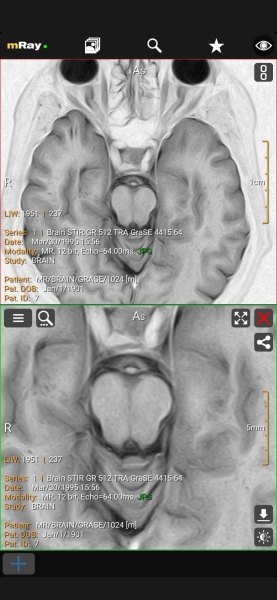 Как и чем открыть формат DCM