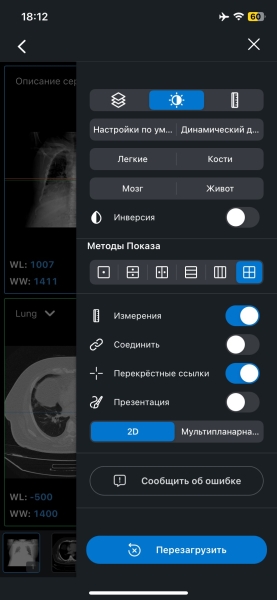Как и чем открыть формат DCM