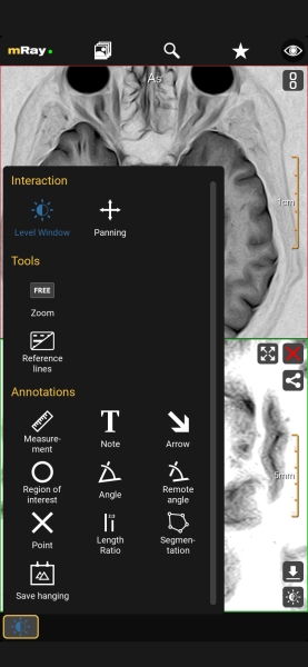 Как и чем открыть формат DCM