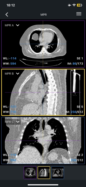 Как и чем открыть формат DCM